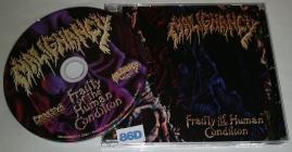 Malignancy-Frailty of the Human Condition- PRRECMML001 -CDEP-FLAC-2024-86D