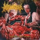 Intestinectomy - Necrophilic Surgeon Fuck Party