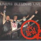Leishmaniasis - Livers Bleeding Live
