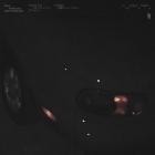 Skrillex - hit me where it hurts x