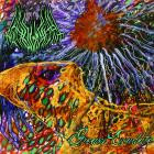 Pathogenesis - Greasy Exudate